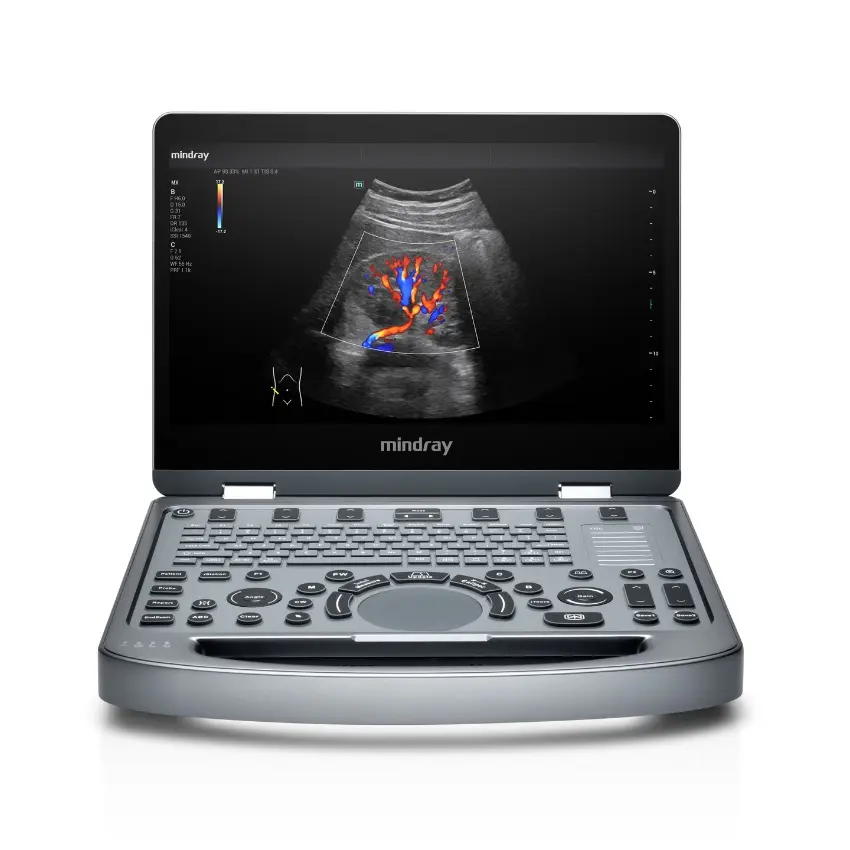 Mindray MX3