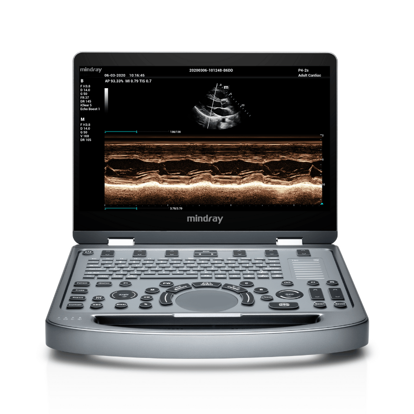 Mindray MX6