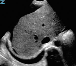 ZONE Sonography