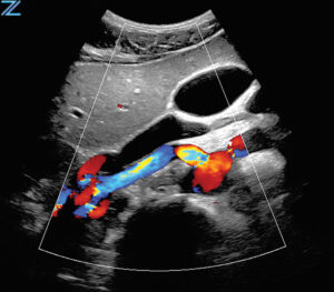 ZONE Sonography
